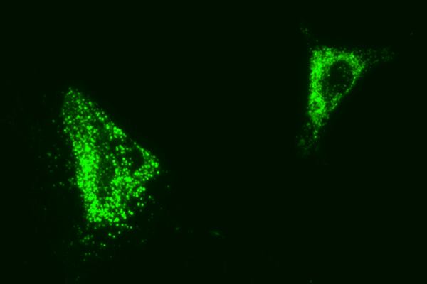 Human mesenchymal stem cells.