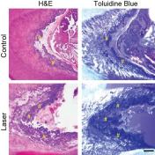 X-ray images showing laser-stimulated growth of dentin (bottom row) versus normal growth (top row). The yellow hashtags sit atop the newly formed tertiary dentin.