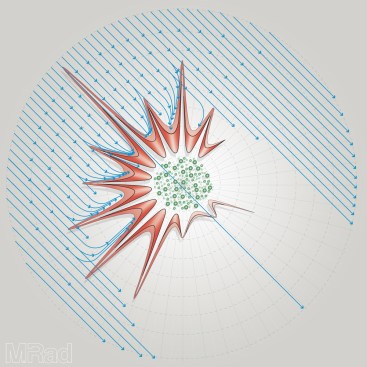 Windflow